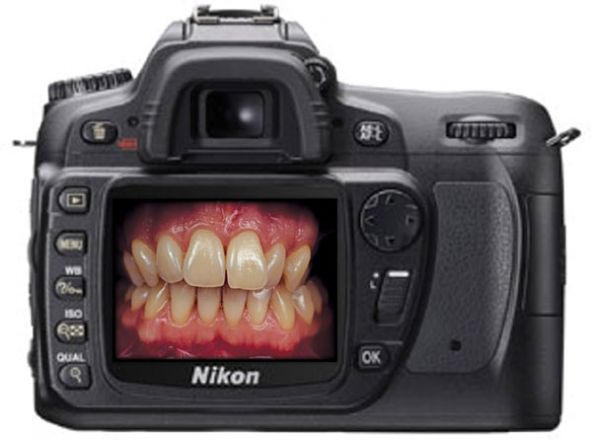4 Clés pour Intégrer la Photographie Dentaire