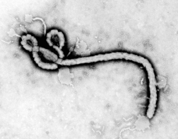 Ebola au Cabinet Dentaire?