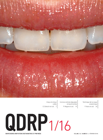 QDPR prothèse dentaire