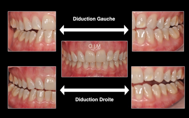 Prothésiste dentaire : Quel est sont rôle ? - Guide dentaire - Dentego