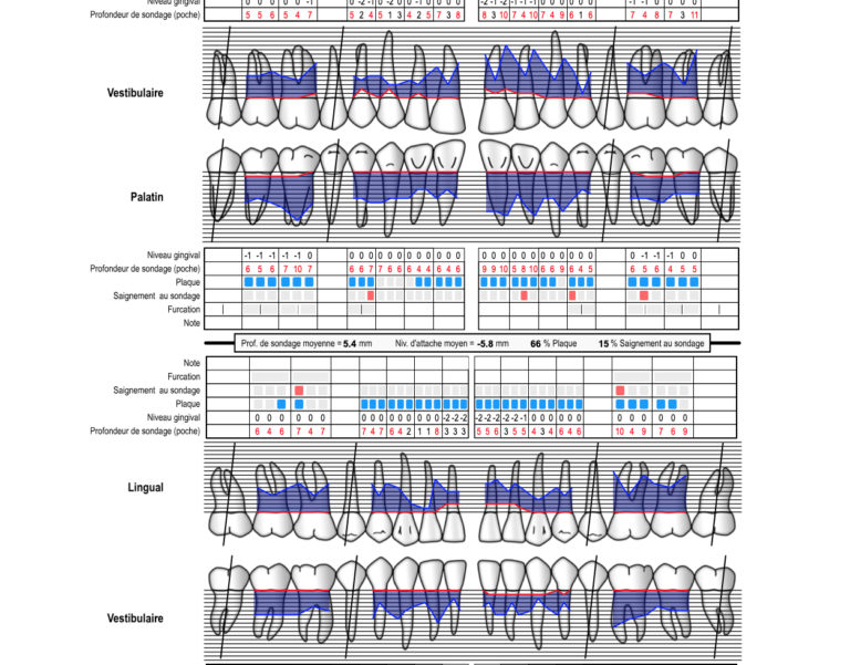 Charting Or Not Charting The Dentalist